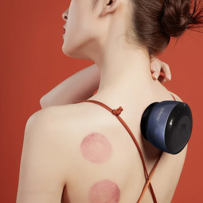 Zdeer Intelligenter Schröpfen-Massager – Wiederaufladbares Vakuum Guasha-Massagegerät zur Linderung von Müdigkeit