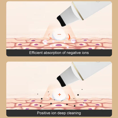 Ultraschaller Gesichts Hautreiniger