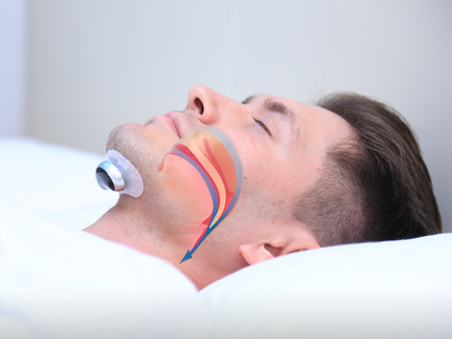 Garduru - Effektives Anti-Schnarch-Gerät mit Puls-Technologie für erholsamen Schlaf